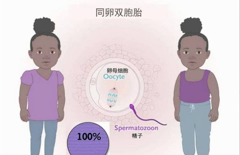 梦见孪生兄弟的解析心理暗示还是未来预兆？