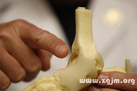 梦见骨折的5个象征意义及解梦方法解析 梦见骨折的5个象征意义及解梦方法解析