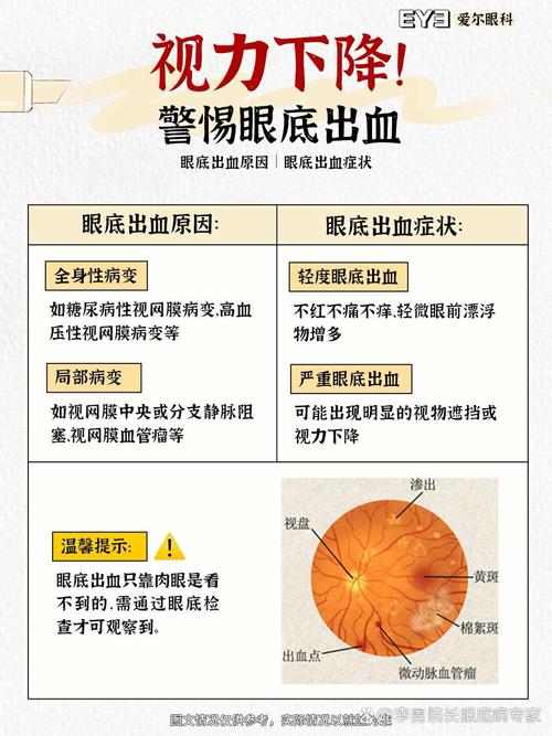 揭秘梦见红眼睛的背后解读6大潜在心理暗示