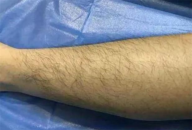 梦见腿毛的深层寓意解析，网友揭开内心隐秘情感！