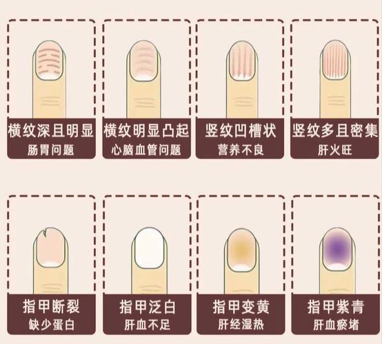 梦见指甲预示解析揭示8种可能含义和应对建议