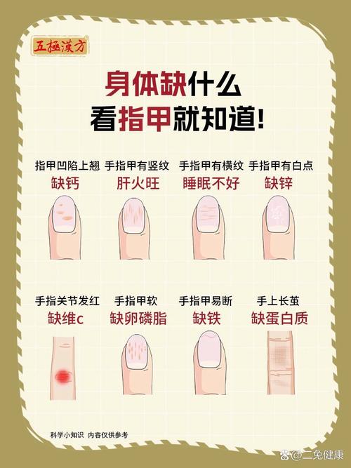 梦见指甲预示解析揭示8种可能含义和应对建议