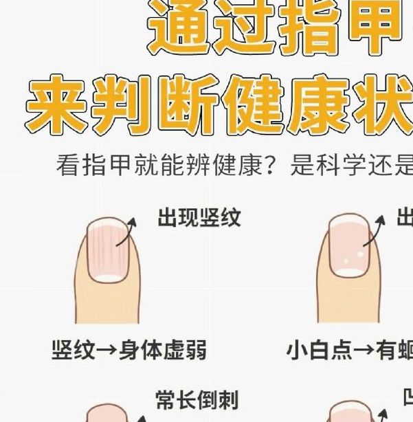 梦见指甲预示解析揭示8种可能含义和应对建议