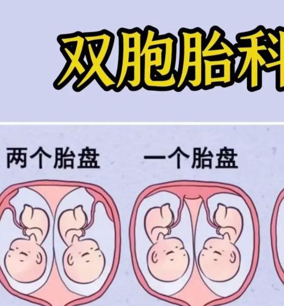 揭秘梦见双胞胎的8大心理暗示,专家解读提升幸福感 揭秘梦见双胞胎的8大心理暗示,专家解读提升幸福感