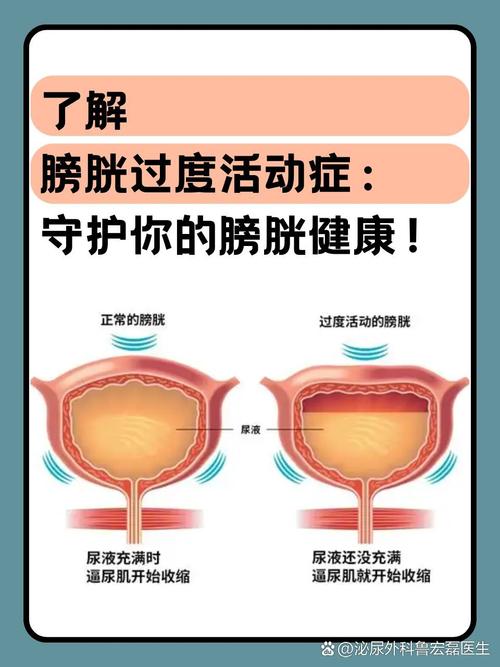 梦见膀胱问题揭秘潜意识影响与高效解决方案 梦见膀胱问题揭秘潜意识影响与高效解决方案