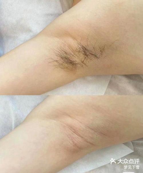 梦见腋毛解析背后含义及4个心理学观点 梦见腋毛解析背后含义及4个心理学观点