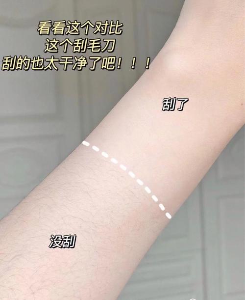 梦见腋毛解析背后含义及4个心理学观点 梦见腋毛解析背后含义及4个心理学观点
