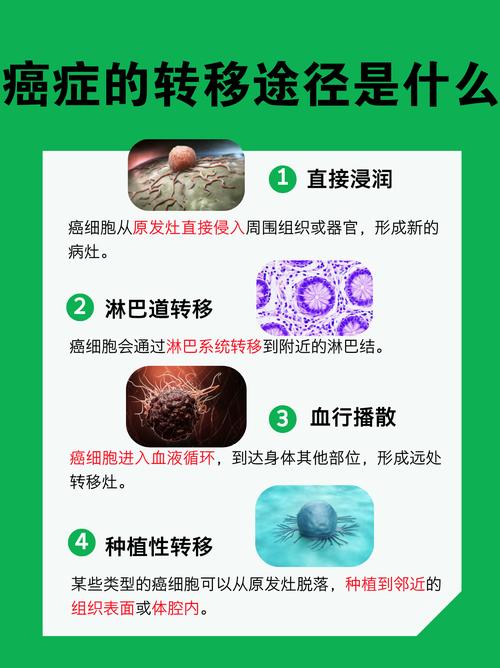 癌细胞为何避毒？揭秘转移机制，助您了解最新抗癌突破
