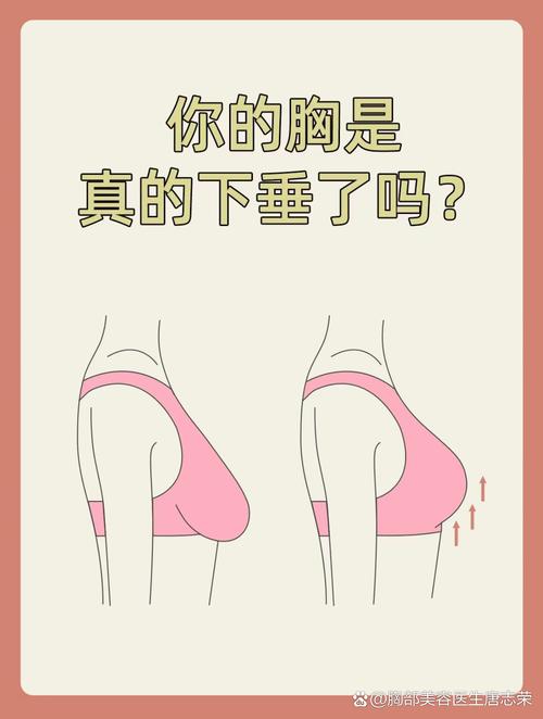梦见胸部下垂意味着哪些?解析心理暗示与调节方法 梦见胸部下垂意味着哪些?解析心理暗示与调节方法