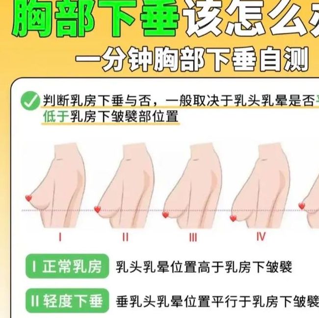 梦见胸部下垂意味着哪些?解析心理暗示与调节方法 梦见胸部下垂意味着哪些?解析心理暗示与调节方法