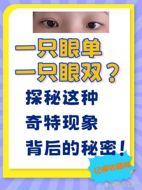 梦见单眼象征哪些?揭开其背后的心理暗示与含义 梦见单眼象征哪些?揭开其背后的心理暗示与含义