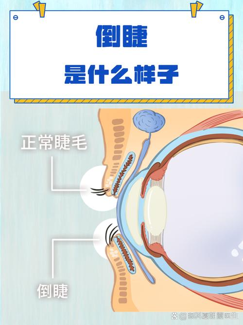 解析梦见睫毛的深层寓意揭示心理状态的3种可能