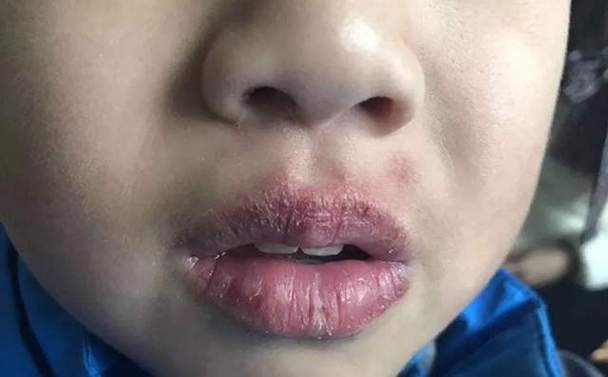 梦见嘴出血的原因及高效解决方案解读梦境的潜在意义