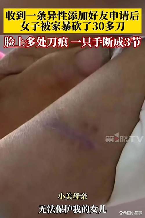 梦见刀片寓意揭秘心理解读与积极应对策略