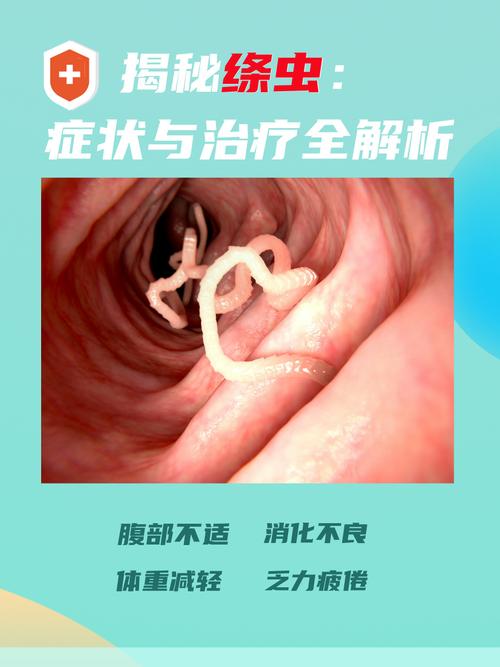 绦虫梦境解析揭示心理暗示及应对策略