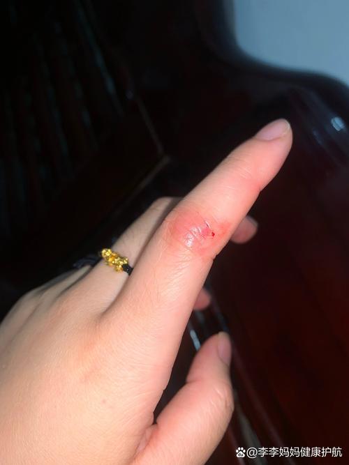 梦见削皮刀预示哪些？深入解读助您规避生活隐患