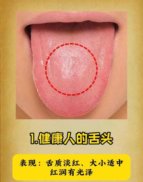 梦见舌头意味着哪些?深入解析心理暗示与健康提示 梦见舌头意味着哪些?深入解析心理暗示与健康提示