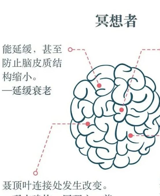 梦见大脑解读背后心理象征，揭示5个深层含义