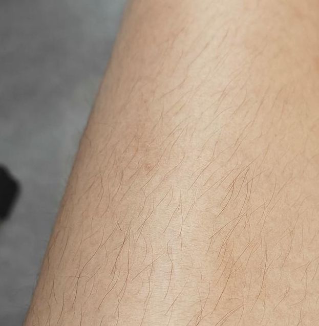 梦见腿毛的7个心理解析专家视角下的潜意识探索