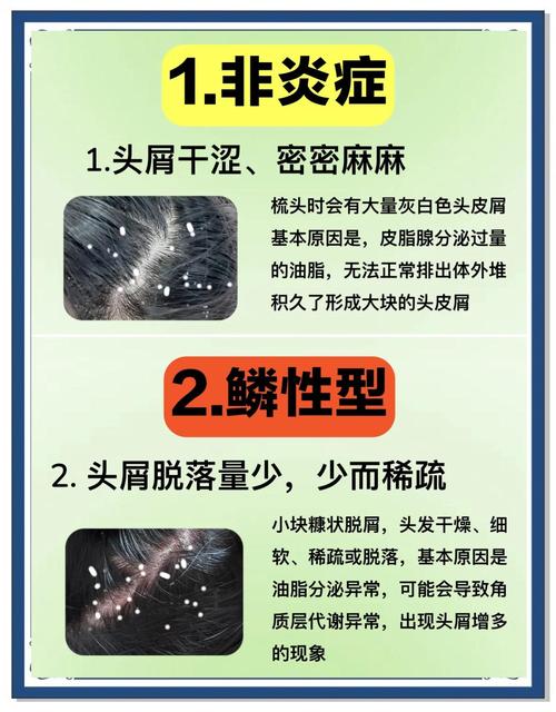深入解析梦见头皮屑的背后含义及应对策略