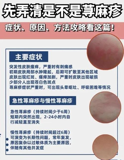 梦见身上痒如何？专家解析背后原因及3个缓解小秘诀