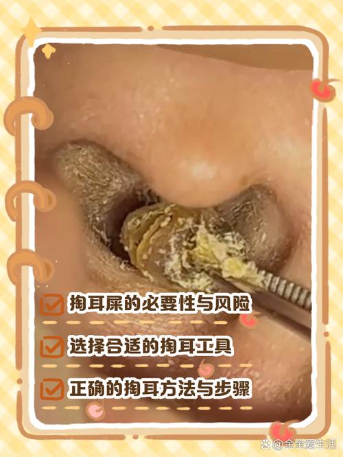 梦见挖耳屎解析: 心理暗示 vs 吉凶预兆，哪个更可信？