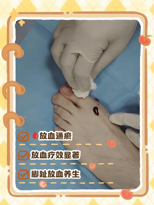 梦见脚趾流血的深层寓意及应对建议