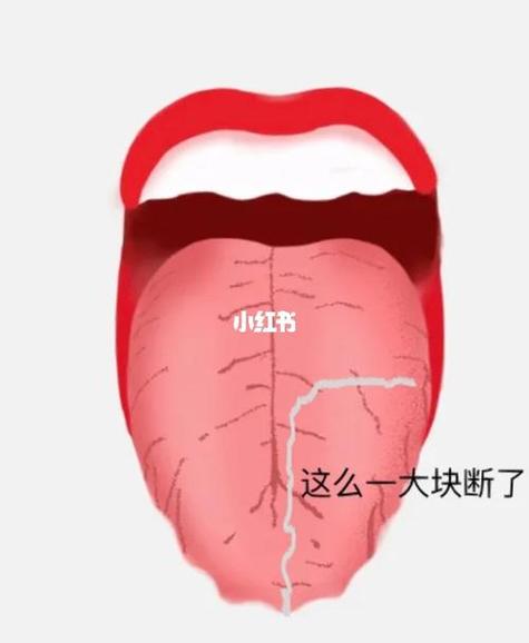 解梦梦见舌头掉了的寓意及心理解析技巧 解梦梦见舌头掉了的寓意及心理解析技巧