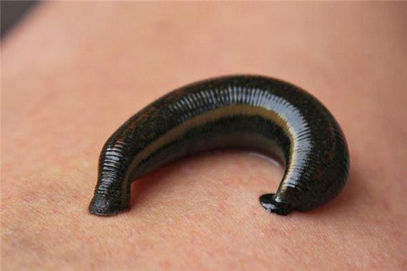 梦见蚂蟥预兆解析高效解决方案揭秘如何化解困扰