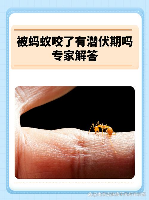 揭秘梦见蚂蚁叼东西的心理解析专家权威解读与4大影响因素