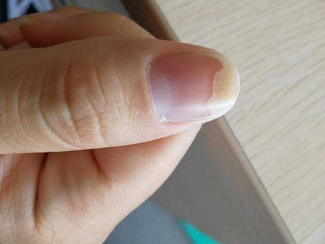 解析梦见弓弦的心理暗示你忽略了哪些潜在信号? 解析梦见弓弦的心理暗示你忽略了哪些潜在信号?