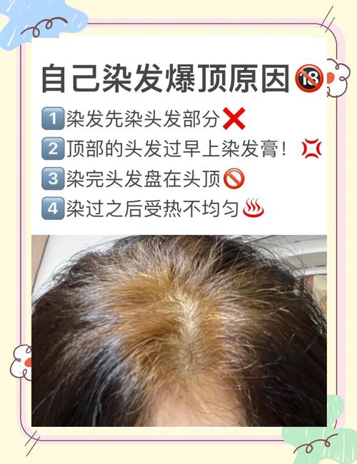 梦见染发解梦揭秘5大心理暗示背后的真实含义 梦见染发解梦揭秘5大心理暗示背后的真实含义