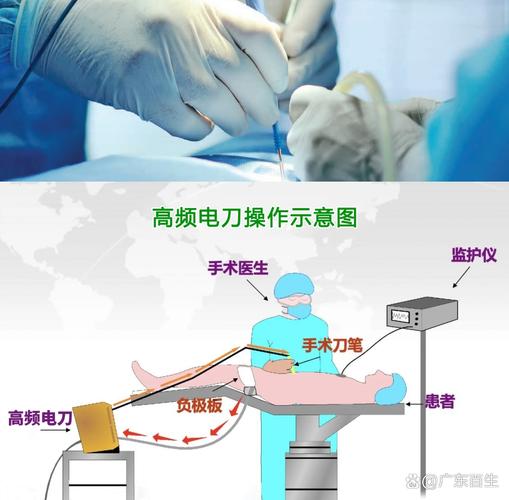 梦见外科手术工具意味着哪些？揭示梦境背后的心理暗示