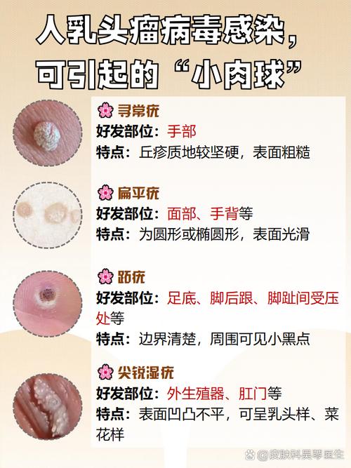 探索：小分子化合物能抑制皮肤型HPV吗？