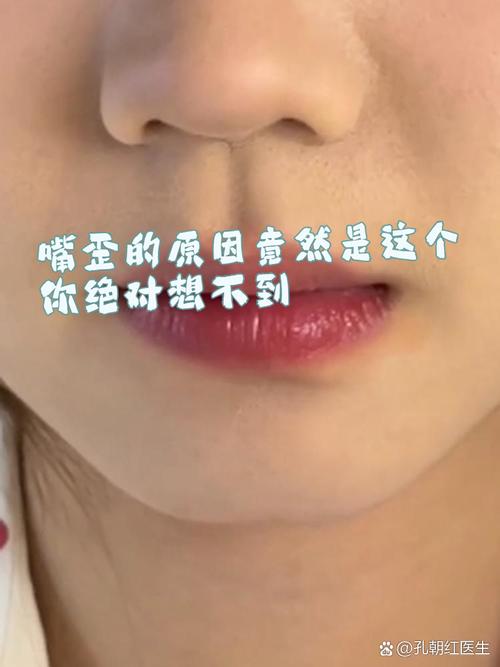 梦见嘴歪解析心理暗示与现实意义对比分析。