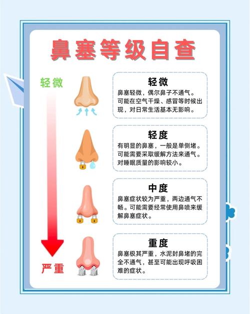 梦见鼻塞预示哪些?解读梦境暗藏的健康信号! 梦见鼻塞预示哪些?解读梦境暗藏的健康信号!