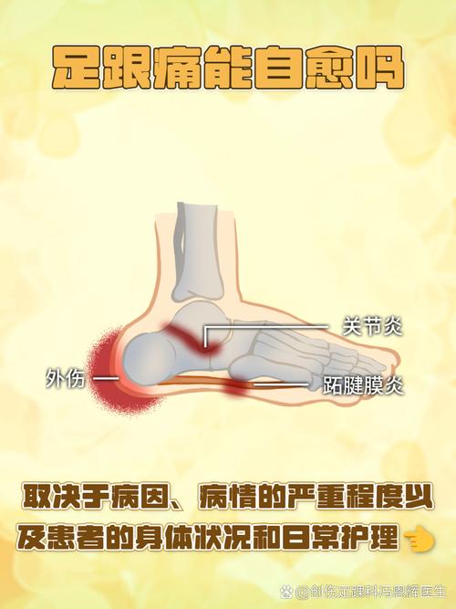 为何梦见脚跟？解析梦境含义与心理高效解决方案