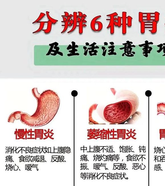 权威解读梦见胃痛的5个可能原因及应对建议 权威解读梦见胃痛的5个可能原因及应对建议