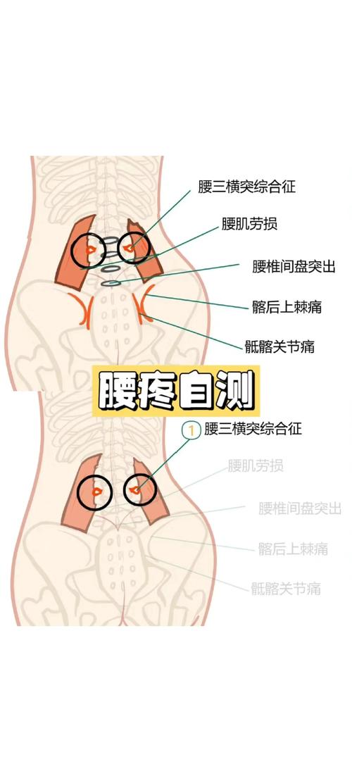 梦见腰痛暗藏的健康信号揭示原因与应对策略