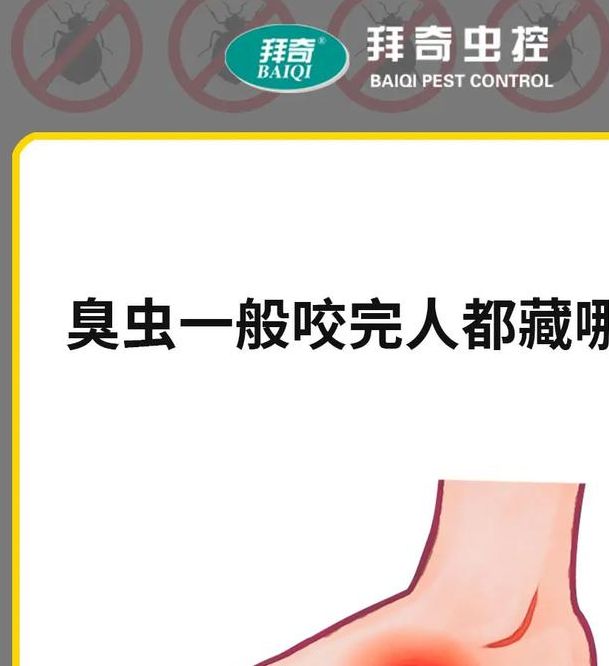 梦见臭虫的深刻寓意，专家分析揭示内心焦虑的缘由！