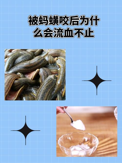 梦见被蚂蟥叮是哪些预兆?解读梦境背后的心理暗示 梦见被蚂蟥叮是哪些预兆?解读梦境背后的心理暗示