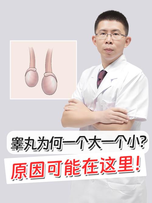 梦见睾丸的隐秘寓意心理暗示还是生活启示？