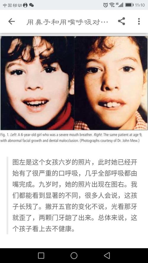 梦见自己变丑了?解读5个潜藏心理信号 梦见自己变丑了?解读5个潜藏心理信号