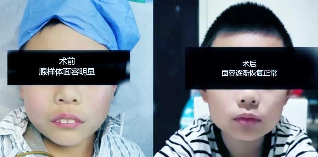 梦见自己变丑了?解读5个潜藏心理信号 梦见自己变丑了?解读5个潜藏心理信号