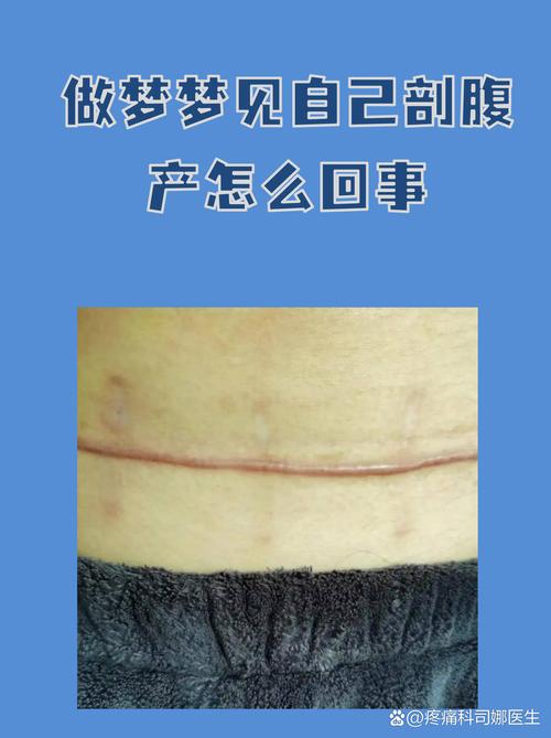 梦见静脉血管的5大象征意义,揭秘梦境背后的心理暗示 梦见静脉血管的5大象征意义,揭秘梦境背后的心理暗示